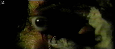 Joe's eye, stage 2