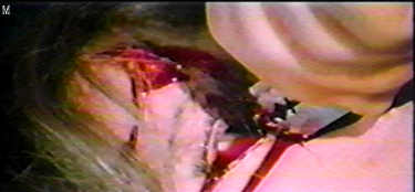 Another shot of the eyeball slice from THE NEW YORK RIPPER