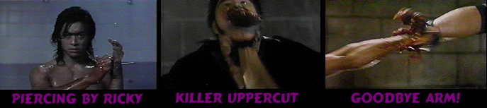 A Nail through the hand, a punch through the jaw, and a shattered forearm!!!